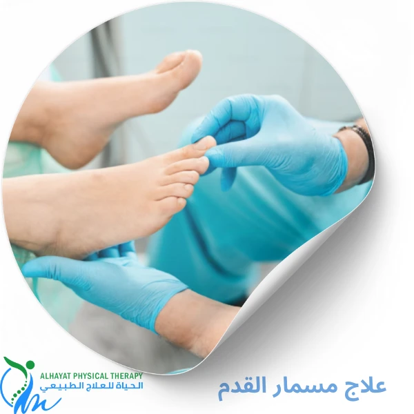 علاج مسمار القدم
