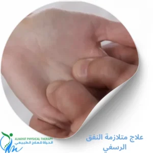 علاج متلازمة النفق الرسغي بالرياض
